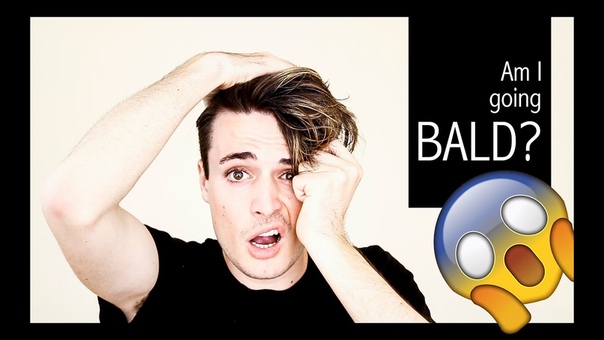 Am I going BALD Baldness Prevention Tips, Mens Hair Loss