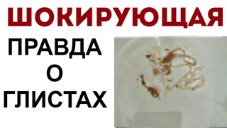 У 9 из 10 человек на чистках выходят паразиты. Но анализы не показывают наличие заражения глистами.