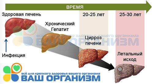В США расследуют уже 109 случаев заболевания у детей, из них 5 с летальным исход