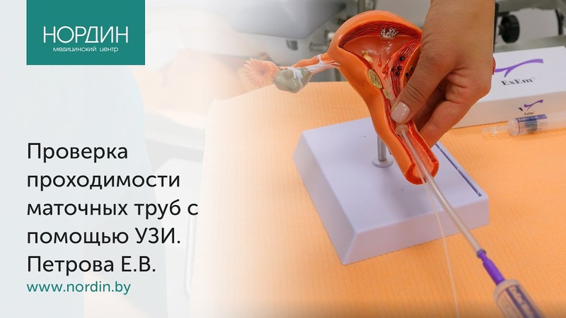 Проверка проходимости маточных труб с помощью