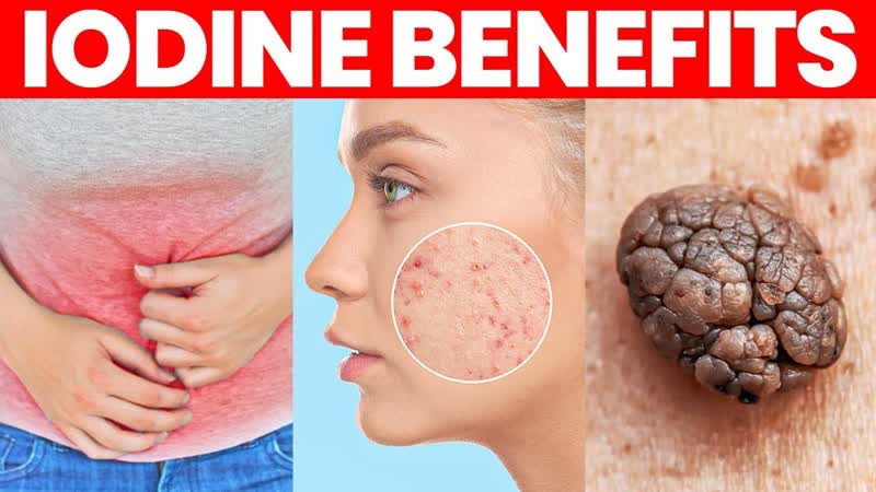The Benefits of Iodine, Side Effects and